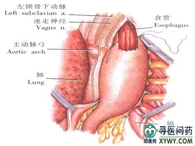 13564143A-TB.jpg